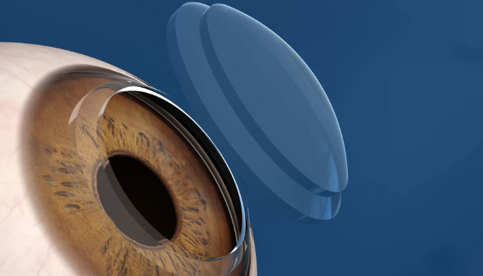 Fotos site - Lumon.png